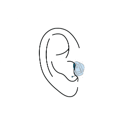 Completely-in-Canal hearing aids illustration